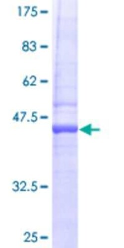 Novus Biologicals Recombinant Human RTKN2 GST (N-Term) Protein 10 &mu;g | Buy Online | Novus Biologicals&trade; | Fisher Scientific