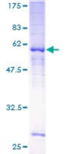 Novus Biologicals Recombinant Human MRGPRF GST (N-Term) Protein 25 &mu;g | Buy Online | Novus Biologicals&trade; | Fisher Scientific