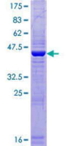 Novus Biologicals Recombinant Human SPATA19 GST (N-Term) Protein 10 &mu;g | Buy Online | Novus Biologicals&trade; | Fisher Scientific