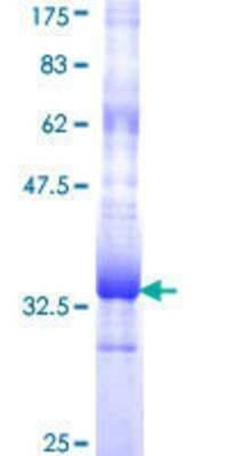 Novus Biologicals Recombinant Human OR5B21 GST (N-Term) Protein 25 &mu;g | Buy Online | Novus Biologicals&trade; | Fisher Scientific