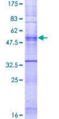 Novus Biologicals Recombinant Human OR5A1 GST (N-Term) Protein 2 &mu;g | Buy Online | Novus Biologicals&trade; | Fisher Scientific