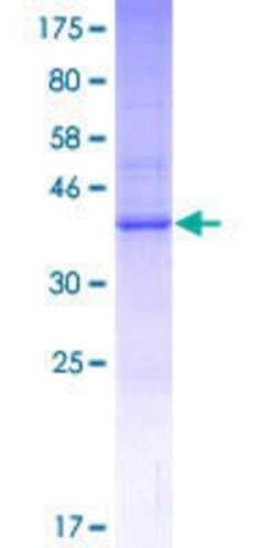 Novus Biologicals Recombinant Human MS4A15 GST (N-Term) Protein 25 &mu;g | Buy Online | Novus Biologicals&trade; | Fisher Scientific
