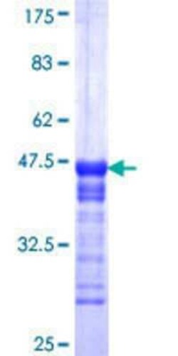 Novus Biologicals Recombinant Human CCDC83 GST (N-Term) Protein 10 &mu;g | Buy Online | Novus Biologicals&trade; | Fisher Scientific