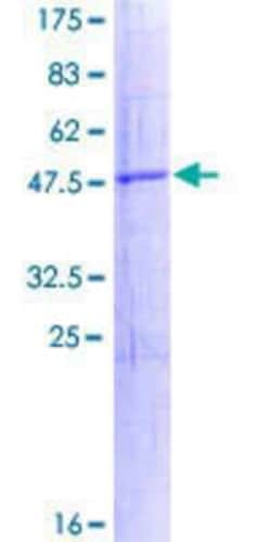 Novus Biologicals Recombinant Human RNF152 GST (N-Term) Protein 25 &mu;g | Buy Online | Novus Biologicals&trade; | Fisher Scientific