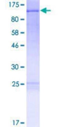 Novus Biologicals Recombinant Human FAM13C1 GST (N-Term) Protein 2 &mu;g | Buy Online | Novus Biologicals&trade; | Fisher Scientific
