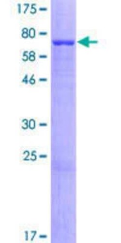Novus Biologicals Recombinant Human RASGEF1A GST (N-Term) Protein 10 &mu;g | Buy Online | Novus Biologicals&trade; | Fisher Scientific