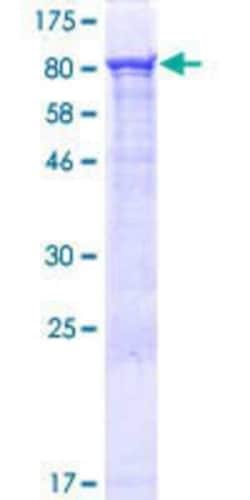 Novus Biologicals Recombinant Human ZUFSP GST (N-Term) Protein 10 &mu;g | Buy Online | Novus Biologicals&trade; | Fisher Scientific
