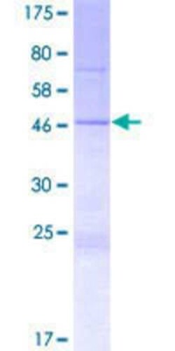 Novus Biologicals Recombinant Human SPATS1 GST (N-Term) Protein 2 &mu;g | Buy Online | Novus Biologicals&trade; | Fisher Scientific