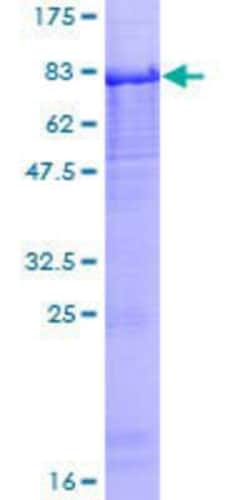 Novus Biologicals Recombinant Human Peptidase Inhibitor 16/PI16 GST (N-Term) Protein 25 &mu;g | Buy Online | Novus Biologicals&trade; | Fisher Scientific