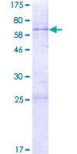 Novus Biologicals Recombinant Human ARMC12 GST (N-Term) Protein 2 &mu;g | Buy Online | Novus Biologicals&trade; | Fisher Scientific