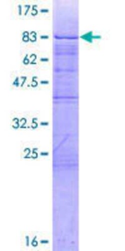 Novus Biologicals Recombinant Human Zinc finger and BTB domain-containing protein 9 GST (N-Term) Protein 2 &mu;g | Buy Online | Novus Biologicals&trade; | Fisher Scientific