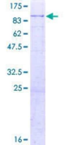 Novus Biologicals Recombinant Human PHACTR1 GST (N-Term) Protein 2 &mu;g | Buy Online | Novus Biologicals&trade; | Fisher Scientific