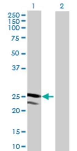 Novus Biologicals&trade;&nbsp;TMED4 293T Cell Transient Overexpression Lysate