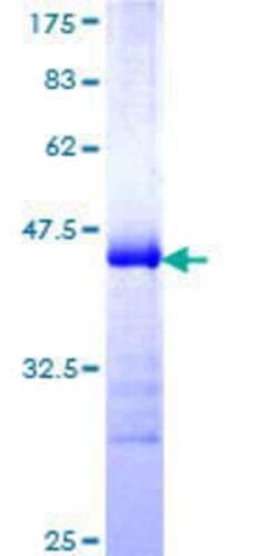 Novus Biologicals Recombinant Human LNX2 GST (N-Term) Protein 10 &mu;g | Buy Online | Novus Biologicals&trade; | Fisher Scientific