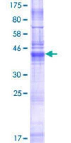 Novus Biologicals Recombinant Human LHFPL5 GST (N-Term) Protein 25 &mu;g | Buy Online | Novus Biologicals&trade; | Fisher Scientific