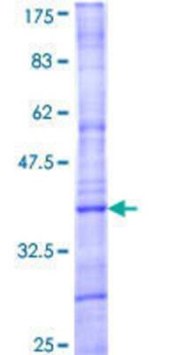 Novus Biologicals Recombinant Human MAPK15 GST (N-Term) Protein 25 &mu;g | Buy Online | Novus Biologicals&trade; | Fisher Scientific