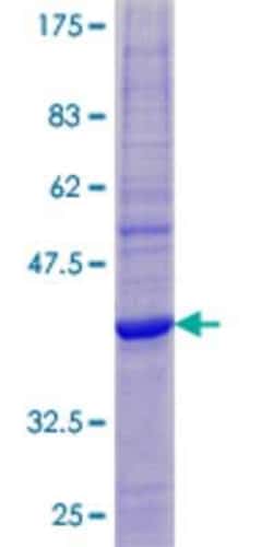 Novus Biologicals Recombinant Human MS4A6E GST (N-Term) Protein 10 &mu;g | Buy Online | Novus Biologicals&trade; | Fisher Scientific