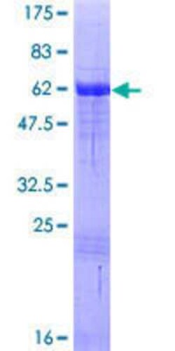 Novus Biologicals Recombinant Human VGLL2 GST (N-Term) Protein 25 &mu;g | Buy Online | Novus Biologicals&trade; | Fisher Scientific