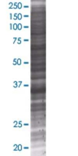 Novus Biologicals VGLL2 293T Cell Transient Overexpression Lysate 0.1 mL | Buy Online | Novus Biologicals&trade; | Fisher Scientific
