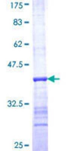 Novus Biologicals Recombinant Human RNase H1 GST (N-Term) Protein 10 &mu;g | Buy Online | Novus Biologicals&trade; | Fisher Scientific