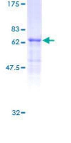 Novus Biologicals Recombinant Human STAC3 GST (N-Term) Protein 10 &mu;g | Buy Online | Novus Biologicals&trade; | Fisher Scientific