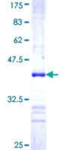 Novus Biologicals Recombinant Human Rictor GST (N-Term) Protein 10 &mu;g | Buy Online | Novus Biologicals&trade; | Fisher Scientific