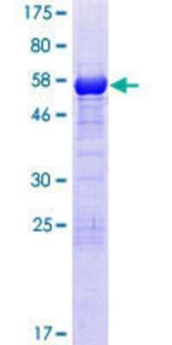 Novus Biologicals&trade;&nbsp;Recombinant Human FAM21C GST (N-Term) Protein