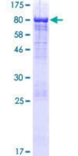 Novus Biologicals Recombinant Human LRRC43 GST (N-Term) Protein 25 &mu;g | Buy Online | Novus Biologicals&trade; | Fisher Scientific