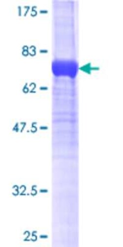 Novus Biologicals Recombinant Human Sorting Nexin 32 GST (N-Term) Protein