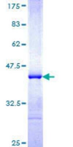 Novus Biologicals Recombinant Human FBXO33 GST (N-Term) Protein 10 &mu;g | Buy Online | Novus Biologicals&trade; | Fisher Scientific