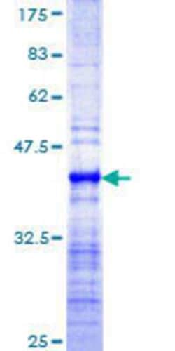 Novus Biologicals Recombinant Human RNF169 GST (N-Term) Protein 25 &mu;g | Buy Online | Novus Biologicals&trade; | Fisher Scientific