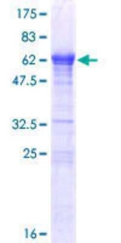 Novus Biologicals Recombinant Human LCORL GST (N-Term) Protein 10 &mu;g | Buy Online | Novus Biologicals&trade; | Fisher Scientific