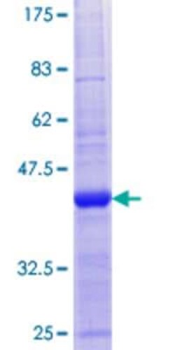 Novus Biologicals Recombinant Human CNIH2 GST (N-Term) Protein 10 &mu;g | Buy Online | Novus Biologicals&trade; | Fisher Scientific