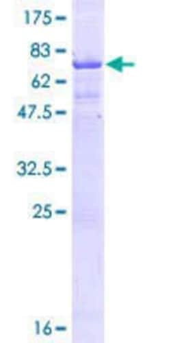 Novus Biologicals&trade;&nbsp;Recombinant Human CT47A11 GST (N-Term) Protein
