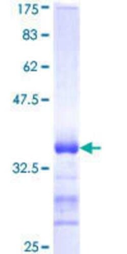 Novus Biologicals Recombinant Human IBRDC2 GST (N-Term) Protein 25 &mu;g | Buy Online | Novus Biologicals&trade; | Fisher Scientific