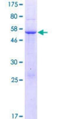 Novus Biologicals Recombinant Human PDZD9 GST (N-Term) Protein 25 &mu;g | Buy Online | Novus Biologicals&trade; | Fisher Scientific