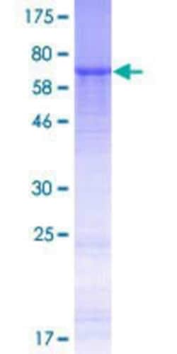 Novus Biologicals&trade;&nbsp;Recombinant Human ADAM5P GST (N-Term) Protein