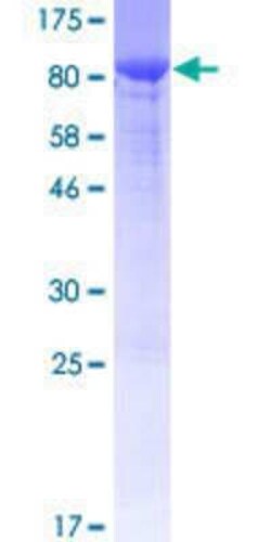 Novus Biologicals Recombinant Human COL29A1 GST (N-Term) Protein 25 &mu;g | Buy Online | Novus Biologicals&trade; | Fisher Scientific