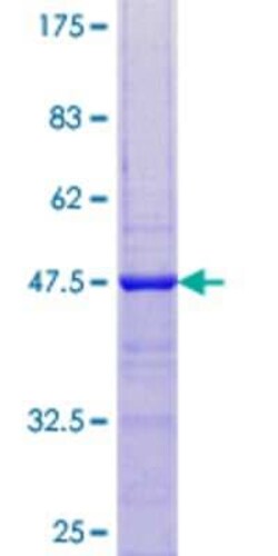 Novus Biologicals&trade;&nbsp;Recombinant Human RPS2P32 GST (N-Term) Protein
