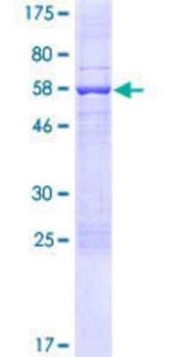 Novus Biologicals Recombinant Human SCML4 GST (N-Term) Protein 25 &mu;g | Buy Online | Novus Biologicals&trade; | Fisher Scientific