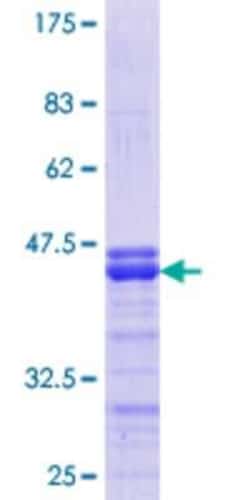 Novus Biologicals Recombinant Human FRMD3 GST (N-Term) Protein 10 &mu;g | Buy Online | Novus Biologicals&trade; | Fisher Scientific