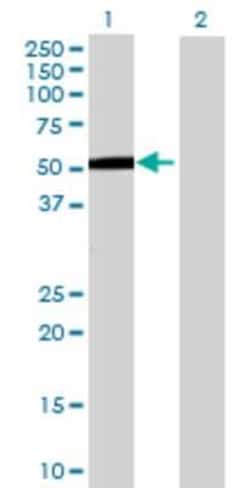 Novus Biologicals&trade;&nbsp;ZNF683 293T Cell Transient Overexpression Lysate