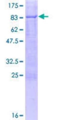 Novus Biologicals Recombinant Human C9orf43 GST (N-Term) Protein 10 &mu;g | Buy Online | Novus Biologicals&trade; | Fisher Scientific