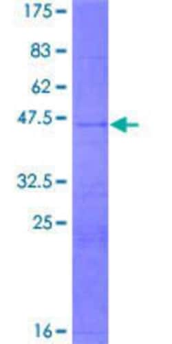 Novus Biologicals Recombinant Human DSCR9 GST (N-Term) Protein 2 &mu;g | Buy Online | Novus Biologicals&trade; | Fisher Scientific