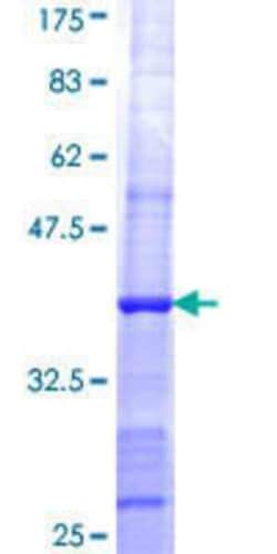 Novus Biologicals Recombinant Human SHPRH GST (N-Term) Protein 25 &mu;g | Buy Online | Novus Biologicals&trade; | Fisher Scientific