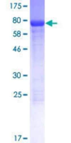 R&D Systems&trade;&nbsp;Recombinant Human ANKS4B GST (N-Term) Protein