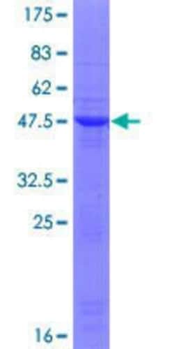Novus Biologicals Recombinant Human TIPRL GST (N-Term) Protein 25 &mu;g | Buy Online | Novus Biologicals&trade; | Fisher Scientific