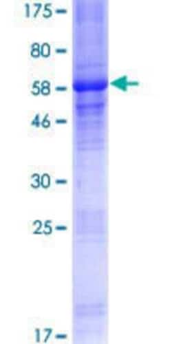 Novus Biologicals Recombinant Human MAGEA2B GST (N-Term) Protein 25 &mu;g | Buy Online | Novus Biologicals&trade; | Fisher Scientific