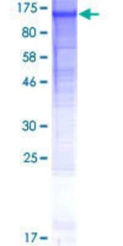 Novus Biologicals Recombinant Human PIPSL GST (N-Term) Protein 10 &mu;g | Buy Online | Novus Biologicals&trade; | Fisher Scientific