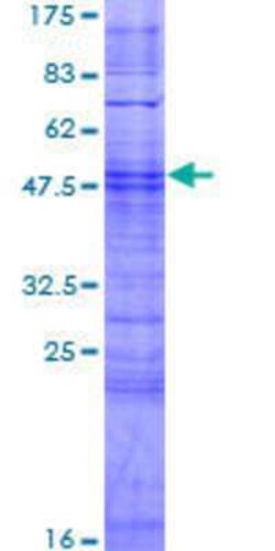 Novus Biologicals Recombinant Human OR10AG1 GST (N-Term) Protein 2 &mu;g | Buy Online | Novus Biologicals&trade; | Fisher Scientific